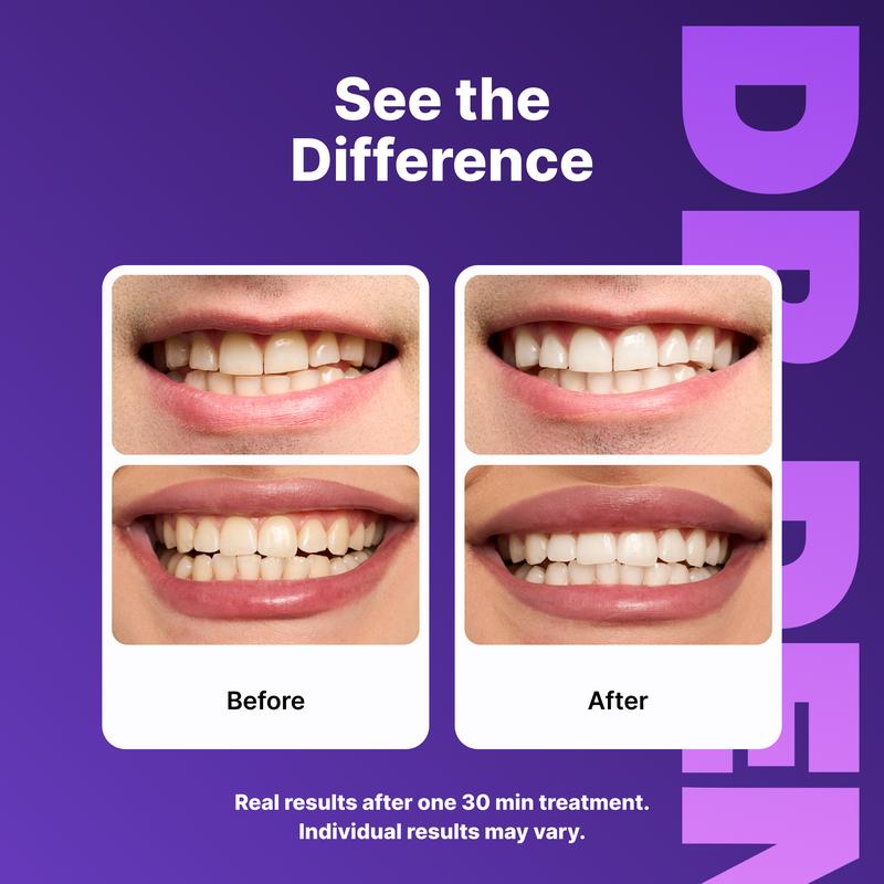 Purple Teeth Whitening Strips - Non Sensitive