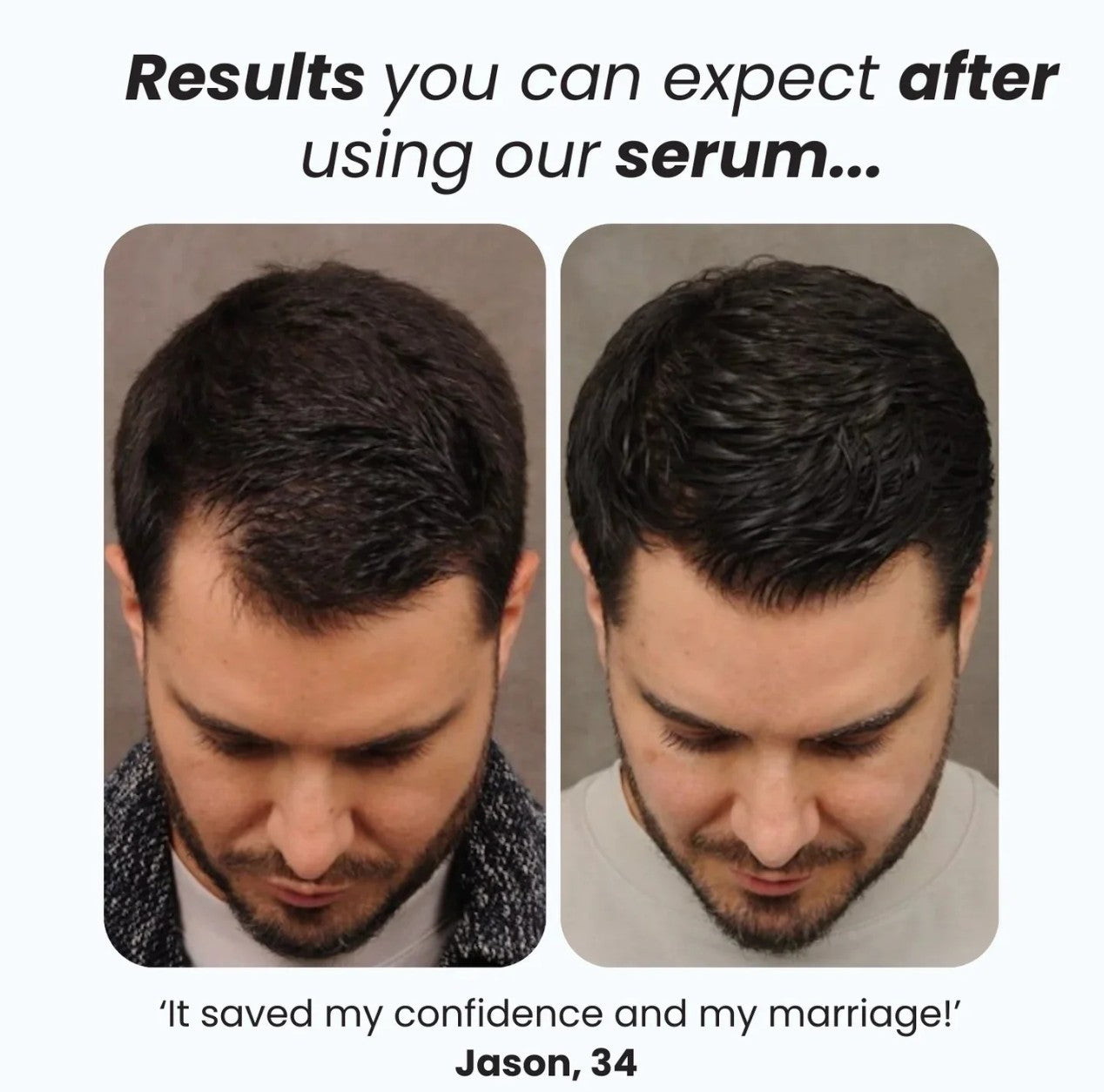 Hair Growth Roll-On Serum